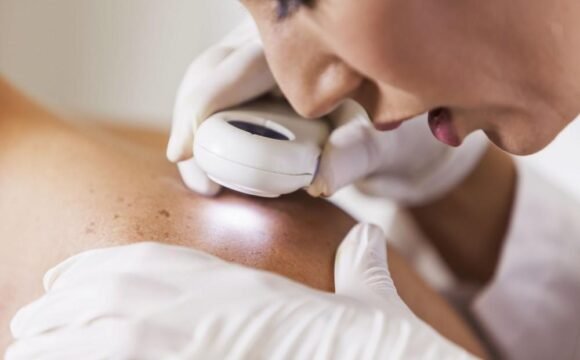 Dermatologji