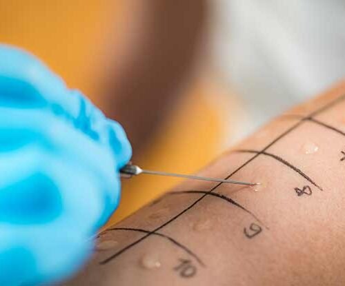 24053-allergist Alergologji