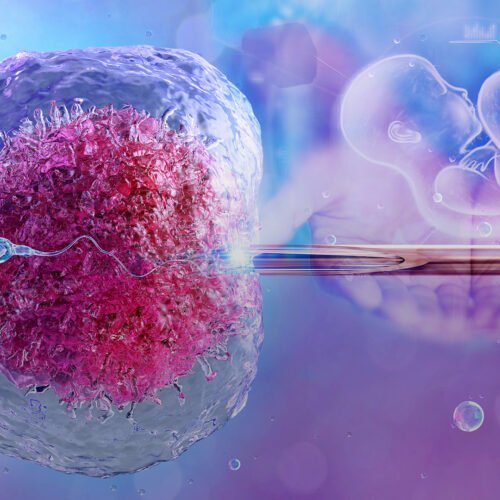 Fekondim In-Vitro (IVF)