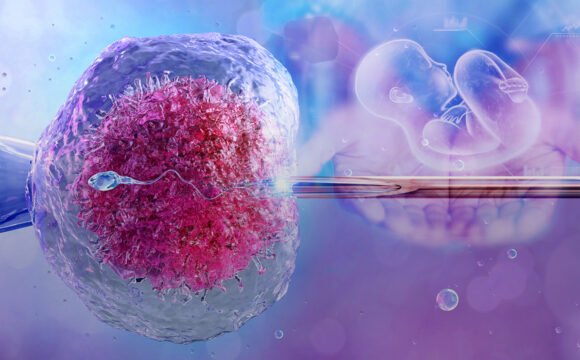 Fekondim In-Vitro (IVF)
