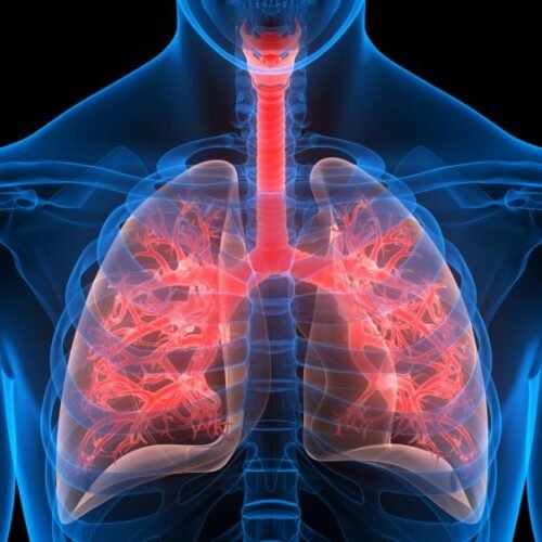 pulmonology Pneumologji